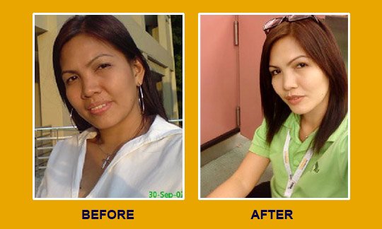 WHITENING PILLS | Glow2Thione | Effective Skin Whitening | Glutathione 